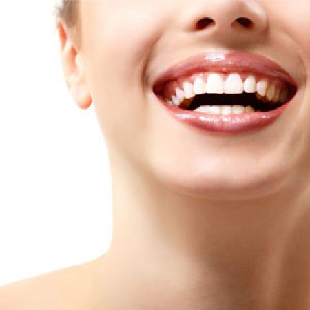 Lush Locks - Teeth Whitening